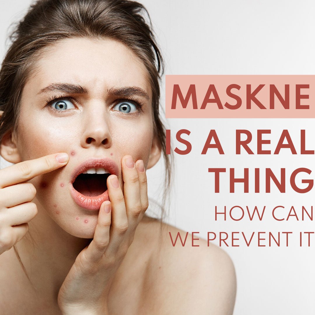 What Is Maskne And How To Prevent It